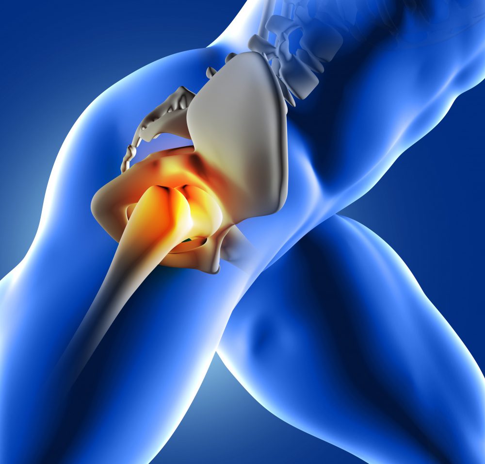 sciatic nerve pain